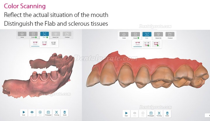 Fussen Dental 3D Digitaler Intraoralscanner